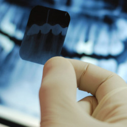 Рентген-диагностика